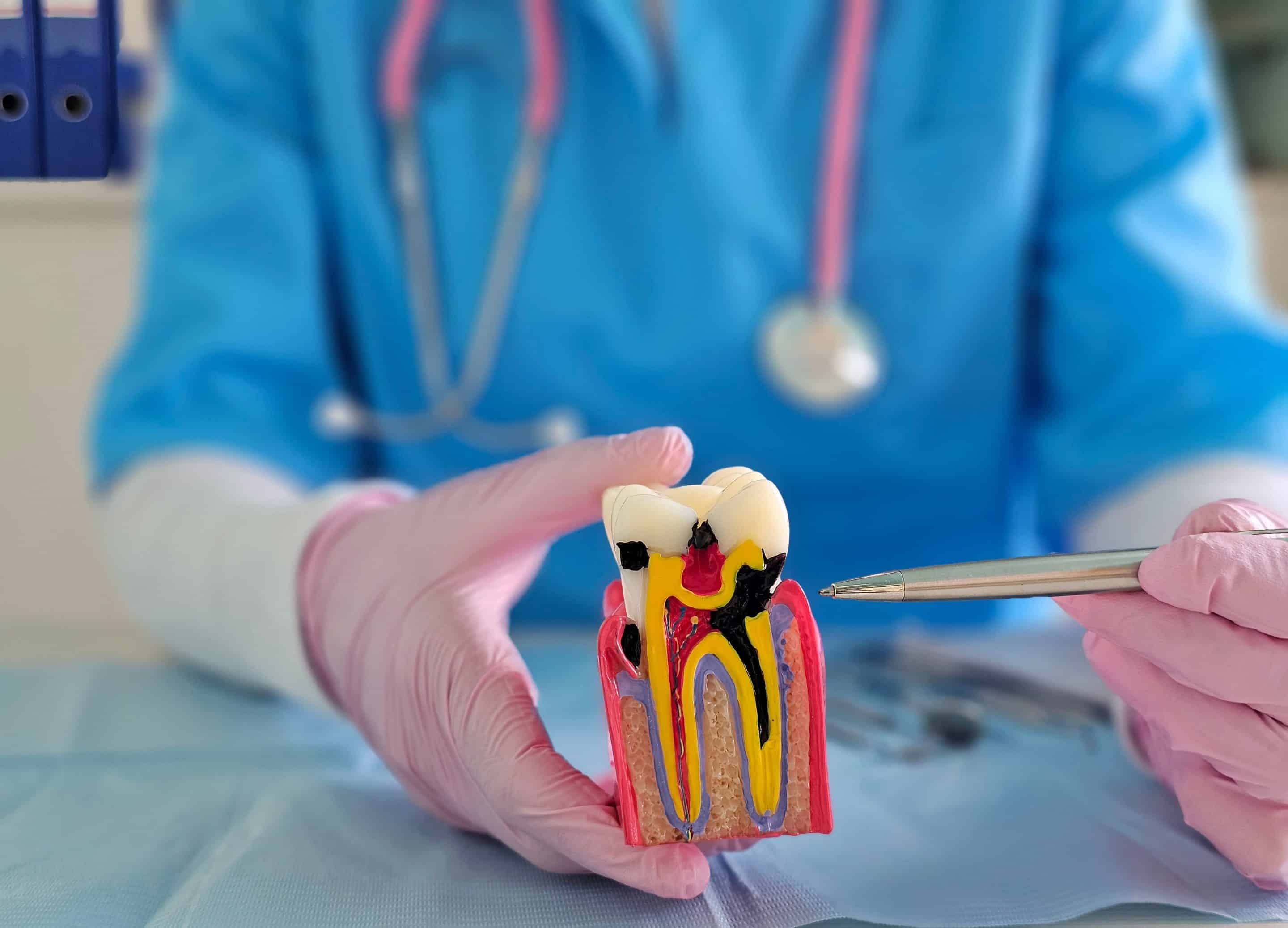 Root canal dentist near Savannah, GA